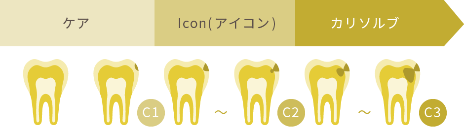 カリソルブが適用されるむし歯の状態
